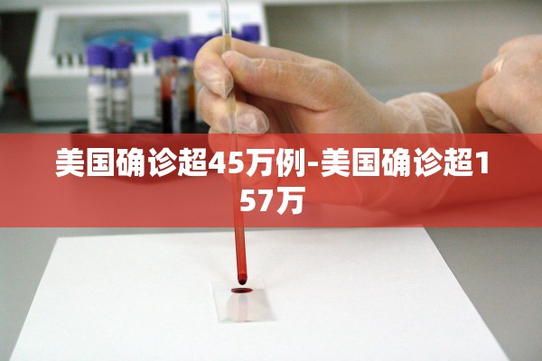 美国确诊超45万例-美国确诊超157万