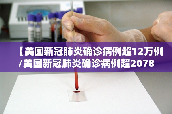 【美国新冠肺炎确诊病例超12万例/美国新冠肺炎确诊病例超2078万】