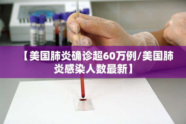 【美国肺炎确诊超60万例/美国肺炎感染人数最新】